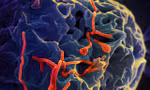 Dịch Ebola diễn biến phức tạp, Bộ Y tế họp khẩn