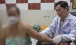 Zona thần kinh tiềm ẩn nhiều biến chứng nghiêm trọng