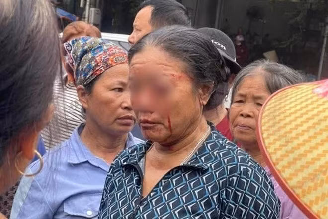 xit-nuoc-chay-mau-ma.jpg