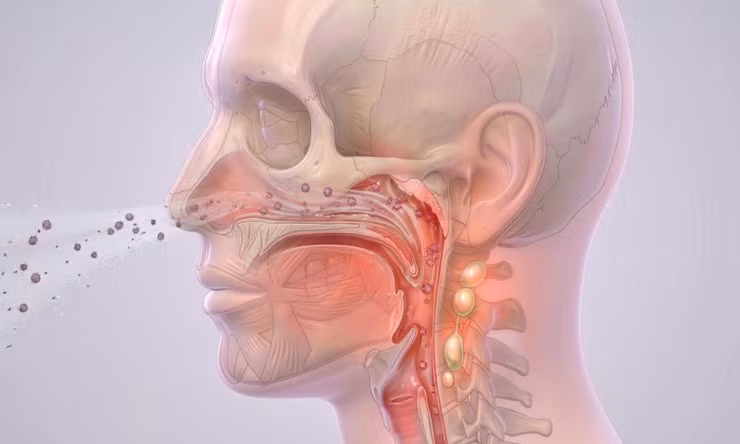 Bệnh não mô cầu nguy hiểm như thế nào và cách nhận biết sớm