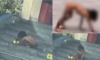 "Đứa trẻ người rừng" ở Trung Quốc gây xôn xao, cha mẹ bảo muốn "thuận tự nhiên"