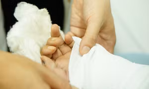 Nối thành công bàn tay của nam công nhân bị chém đứt lìa khi tăng ca đêm
