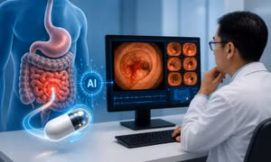 Giải mã ca xuất huyết ruột non bí ẩn nhờ ‘mắt thần AI’