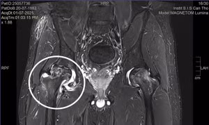 Bác sĩ ngoại quốc chẩn đoán sai, Việt kiều về nước được điều trị khỏi bệnh 