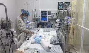 Gần 100 ngày chạy đua với 'tử thần' cứu sống bé trai bị cha phóng hỏa sau ly hôn