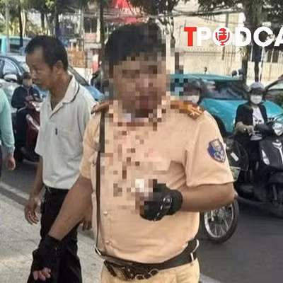 NÓNG 8/8: Phân định pháp lý vụ một trung tá CSGT bị thanh niên người Nga tấn công