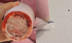 Mảnh kim loại trong sinh tố dâu tây đang gây phẫn nộ cộng đồng mạng