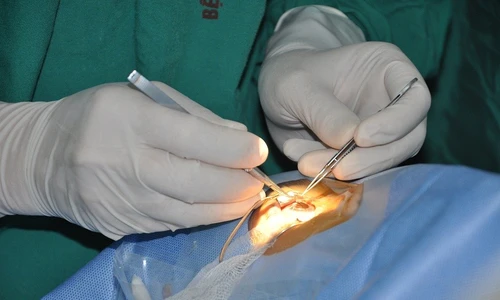 Ra mắt Ngân hàng Mô, cơ hội ghép giác mạc cho hàng nghìn bệnh nhân