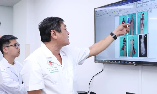 Thiếu niên 15 tuổi dập nát toàn bộ bàn tay vì pháo nổ