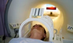 Những người chống chỉ định tuyệt đối không được chụp cộng hưởng từ
