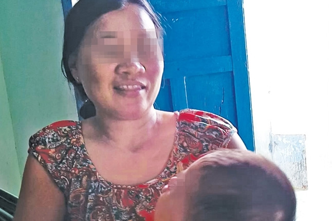 Một trong những bệnh nhi biến chứng sau mổ mắt ở BV Mắt TPHCM.