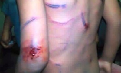 Đầy lằn roi trên người bé trai. Ảnh: A.X