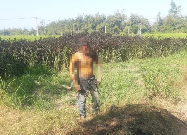 Người đàn ông tẩm xăng tự thiêu may mắn được cứu sống. Ảnh: Dân trí