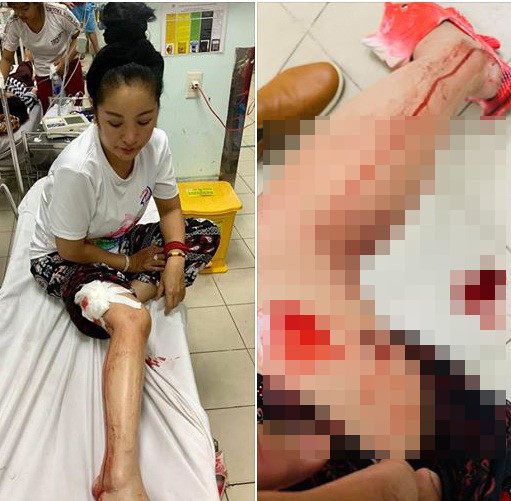 Hình ảnh Thúy Nga trong bệnh viện khiến người hâm mộ hoang mang.