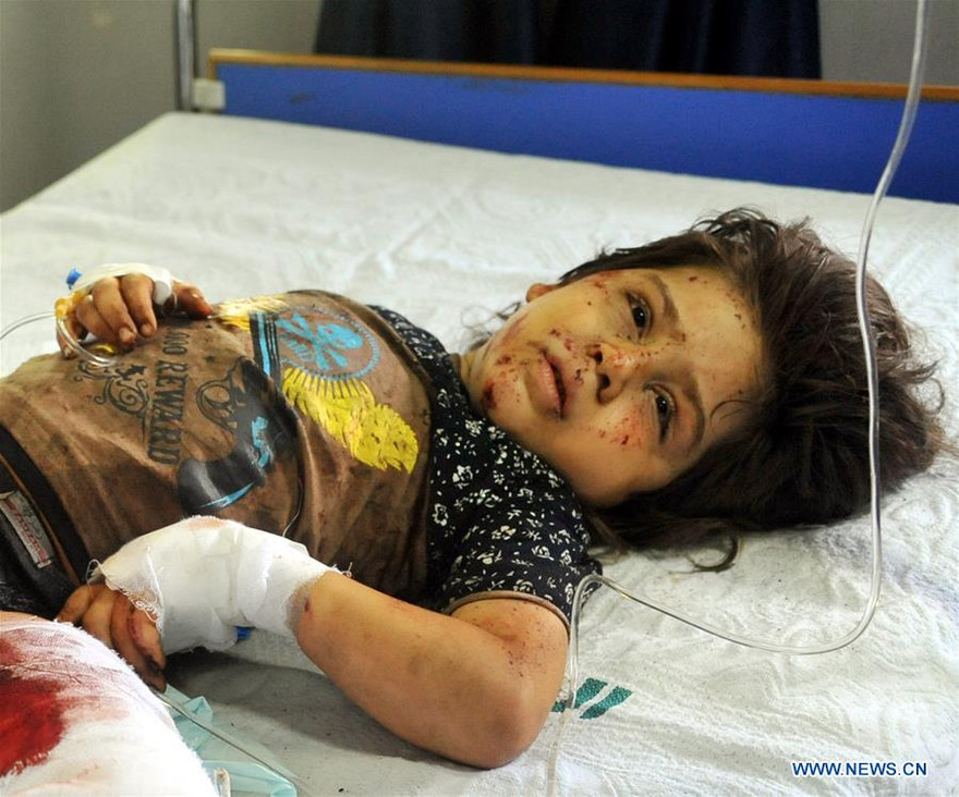 Một bé gái bị thương trong vụ nổ gần quảng trường Tahrir, Damascus, ngày 2/7. Ảnh: Tân Hoa Xã