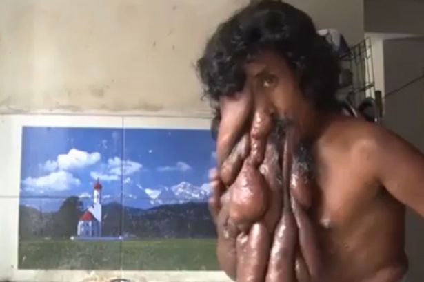 Chuyện đời xót xa của 'người voi' ở Ấn Độ