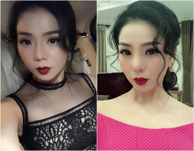 Nguy cơ hoại tử vì sụn mũi, Lệ Quyên nói gì?