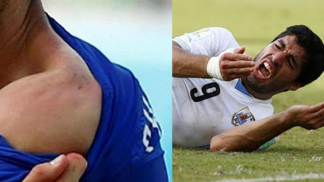 Uruguay khẳng định Suarez cắn Chiellini là photoshop