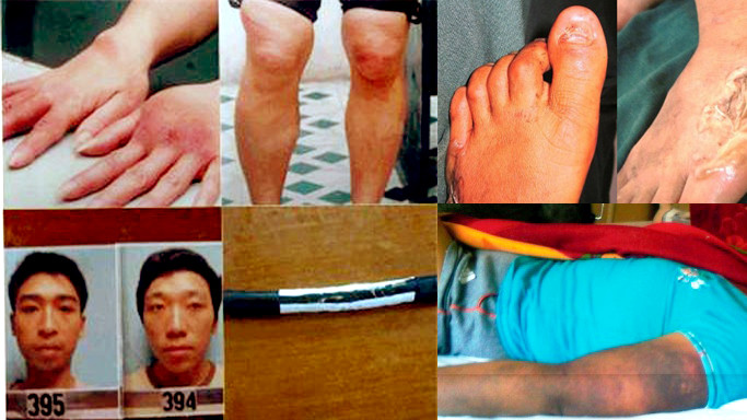 Những vụ dùng 'nhục hình' dã man như thời trung cổ