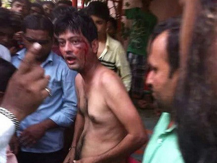 Bị cắt phăng 'của quý' vì cố hiếp dâm cô gái