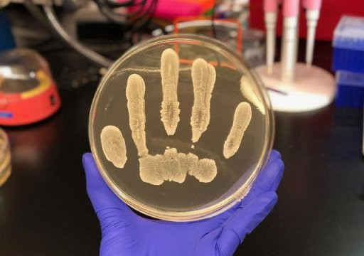  Khuẩn S. epidermidis đang phát triển trên một đĩa thạch (Ảnh: Science Daily) 