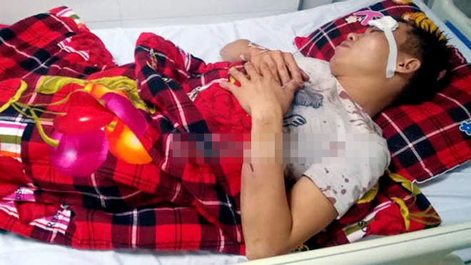 Nạn nhân đang được điều trị tại BVĐK Cửa Đông