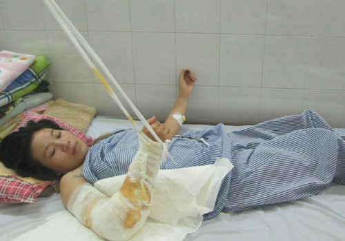 Chị Viện đang được điều trị. Ảnh: Cơ quan công cung cấp