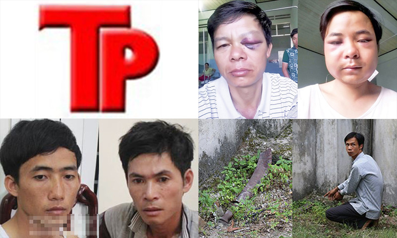 Bản tin Hình sự 18H: Nhóm côn đồ đâm chém, cắt đứt gân tay, chân 'đối thủ'