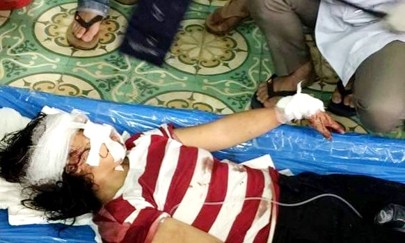 Nạn nhân được đưa đi cấp cứu