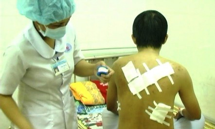 Các vết chém trên người ông Phương