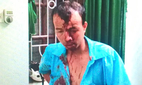 Anh Sơn bị đánh vỡ đầu và mất nhiều máu