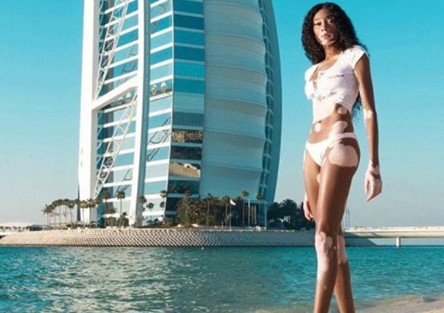 'Siêu mẫu hoang màu' Winnie Harlow đẹp tựa nữ thần trước hoàng hôn