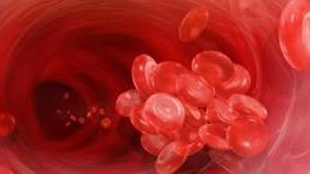 6 dấu hiệu cảnh báo cục máu đông nguy hiểm