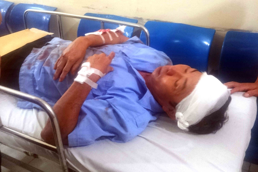 Nạn nhân đang được cấp cứu trong bệnh viện. Ảnh: Thanh Hà.