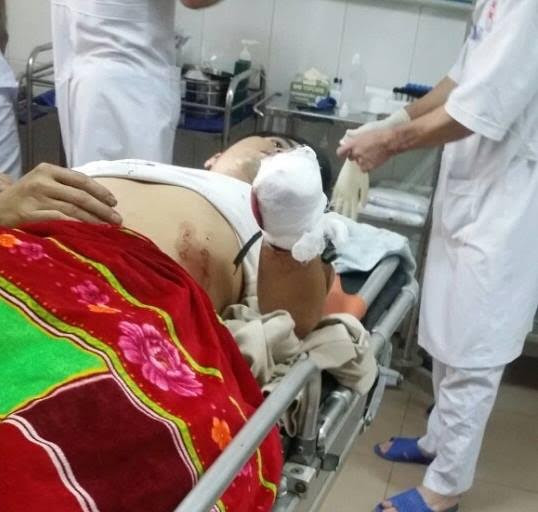 Anh Ngọc đang được điều trị tại bệnh viện.