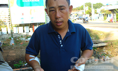 Anh Tú với thương tích khắp người