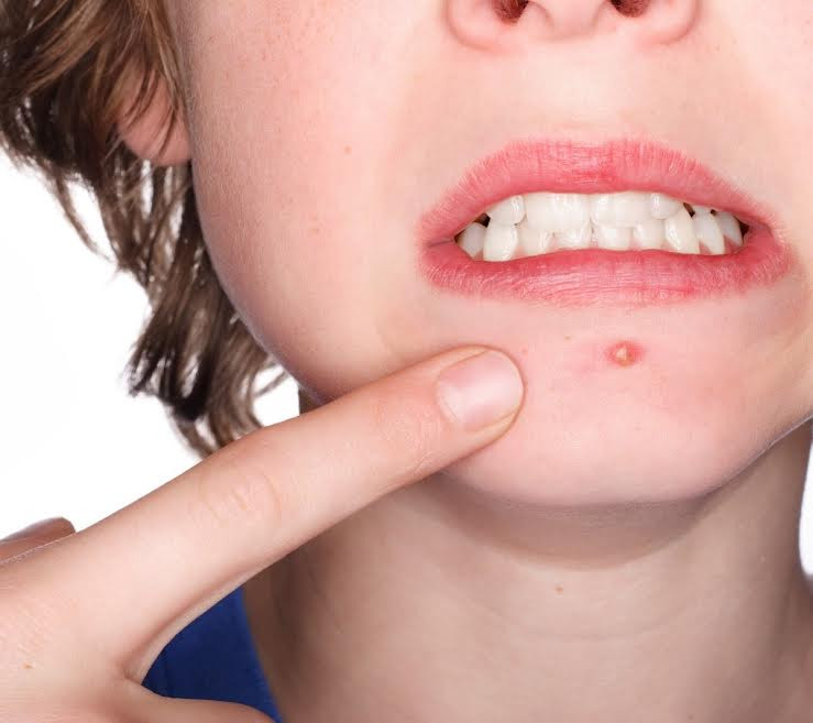 Những biểu hiện khác lạ của cơ thể 'tố cáo' bệnh tật