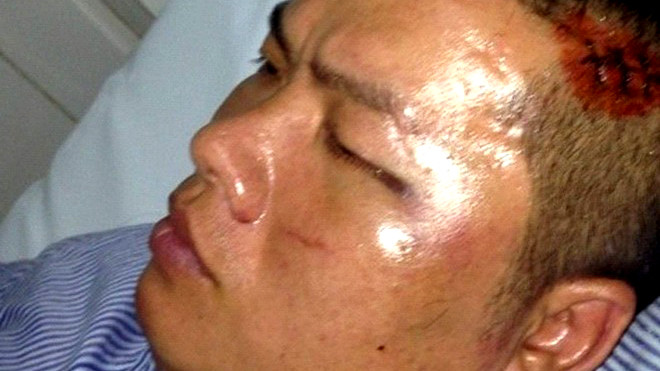 Nguyên thời điểm được cấp cứu tại bệnh viện