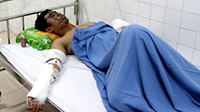 Thái nói rằng không mâu thuẫn với ai để bị tạt axit. Ảnh: Nguyễn Đông