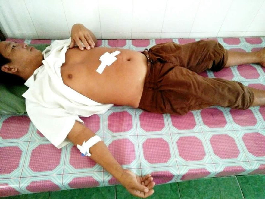 Anh Nguyễn Văn Hưởng chẳng biết lí do vì sao mình lại bị nhóm côn đồ đó tấn công