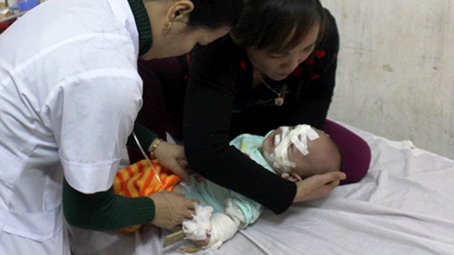 Bé Thùy Linh vẫn đang được các bác sĩ chăm sóc, theo dõi tại bệnh viện Sản - Nhi Nghệ An