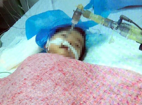 Bé gái 8 tháng tuổi đã tử vong do tiêm nhầm