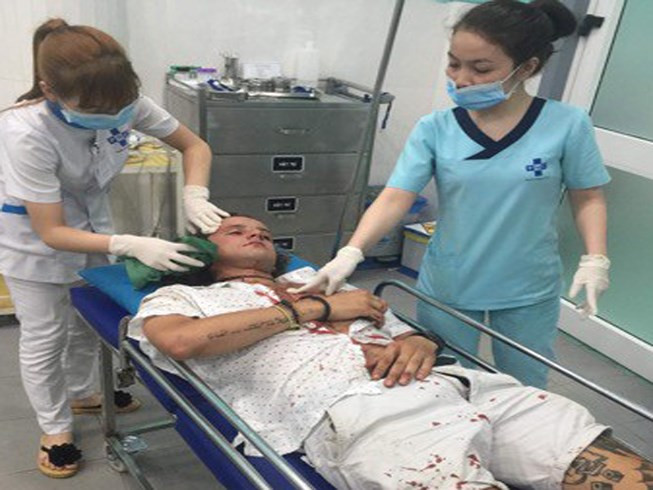 Du khách người Úc bị đánh phải nhập viện