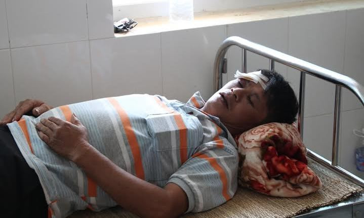 Anh Ngọc đang điều trị tại bệnh viện.