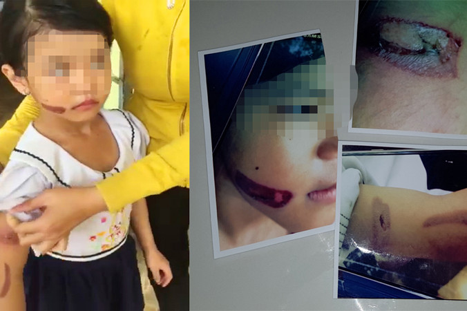 Gia đình kí cam kết hứa cho bé T. trở lại trường.