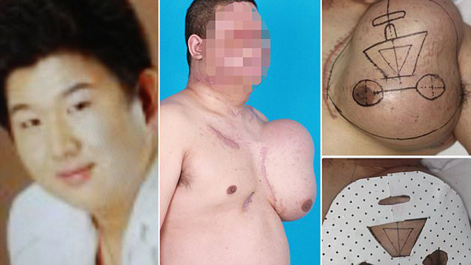 Yan trước khi bị điện giật và khuôn mặt bác sĩ đang tái tạo trên ngực trái.