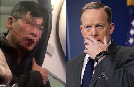 Ông Sean Spicer cho rằng, nhân viên hãng United Airlines nên hành xử khéo léo hơn.