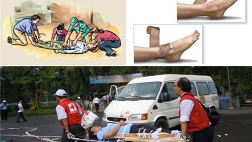 Dùng nẹp cố định xương để hạn chế vận động.