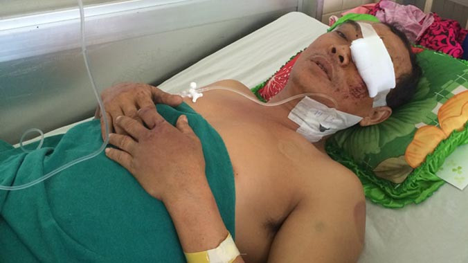 Ông Quảng Văn Tâm (41 tuổi) nhập viện sáng 20/3. Ảnh: Quốc Ngọc.