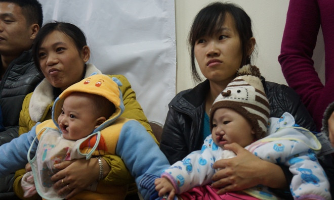 Trẻ hở môi, hàm ếch được phẫu thuật miễn phí